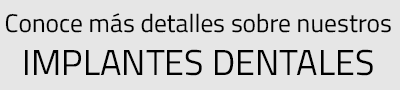 Implantes dentales en Valencia