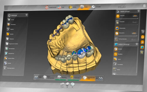 Prótesis dentales sofisticadas en Valencia - Clínica dental Cots
