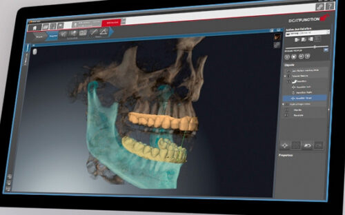 Tratamientos del trastorno de la articulación temporomandibular (TAT) Tratamientos del trastorno de la articulación temporomandibular (TAT) Tratamientos del trastorno de la articulación temporomandibular en Valencia-Clínica dental Cots