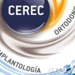 Sistema CEREC de ortodoncia invisible