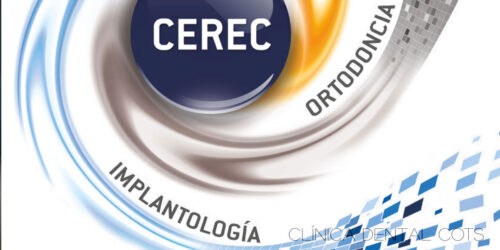 Sistema CEREC de ortodoncia invisible