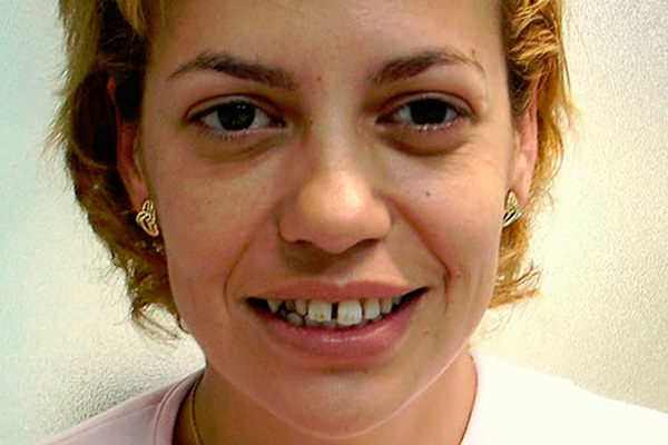 caso de ortodoncia realizado por Clínica Dental Cots 10a