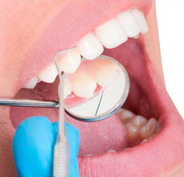 Periodoncia en Valencia Clínica Dental Cots