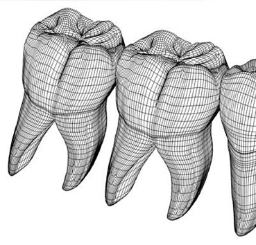 protesis digital dental 3d en valencia - Clínica dental Cots