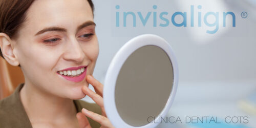 Experiencias de Pacientes con Invisalign