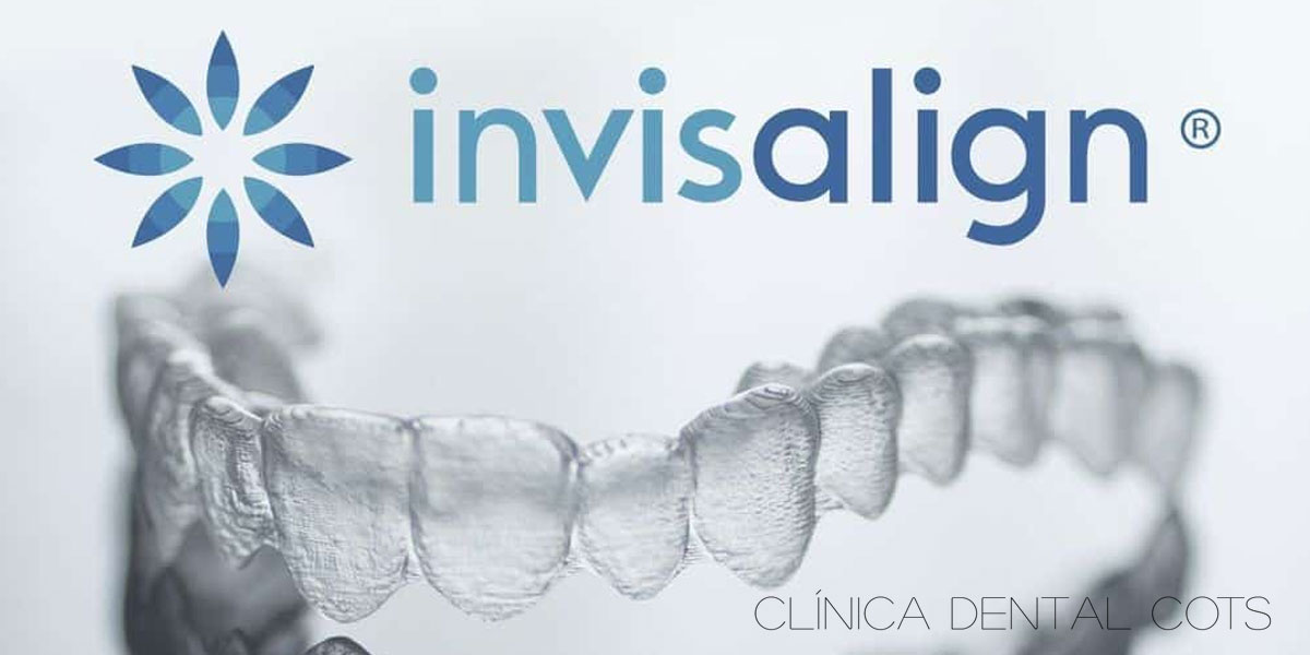 Guía Completa de Invisalign